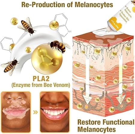 VitiGO Bee Venom Treatment Cream - Image 5