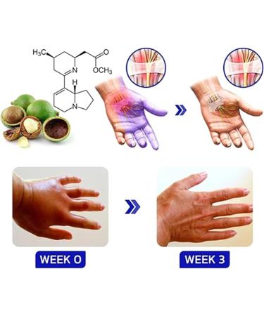 Numbfix Hand and Foot spray - Image 5