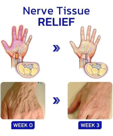 Numbfix Hand and Foot spray - Image 2